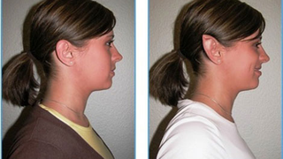 Spock-Ear Plastic Surgery Mod is Not Logical